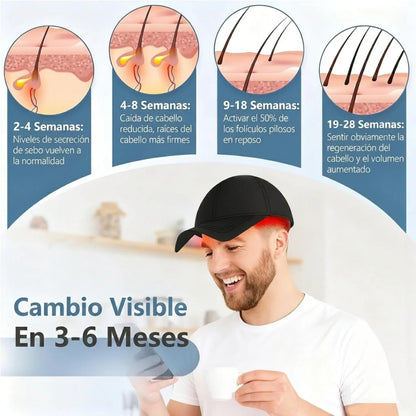 Gorra de Terapia de Luz Roja