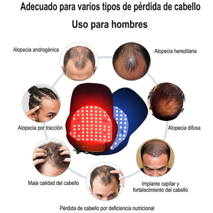 Gorra de Terapia de Luz Roja